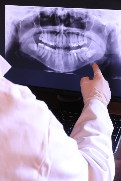 Best Broken or Chipped Tooth Repair in State Line, PA